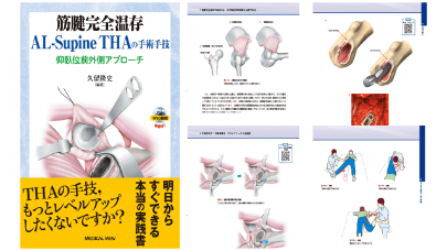 『筋腱完全温存AL-Supine THAの手術手技　仰臥位前外側アプローチ』の書籍の画像