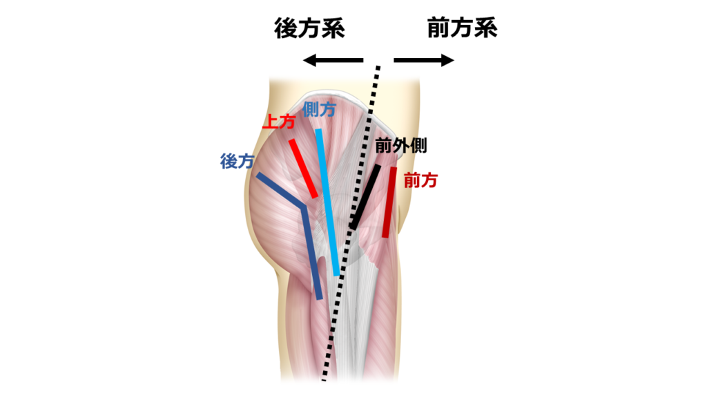 前方系アプローチと後方系アプローチので切開する場所が違うことを表す画像
